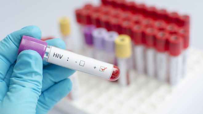 HIV vaccine shows promise in human trial