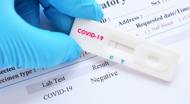 Free Testing For Medically Screened COVID-19 Cases