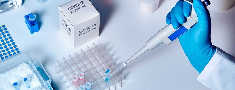 Laos Changes Conditions For Covid-19 Tests