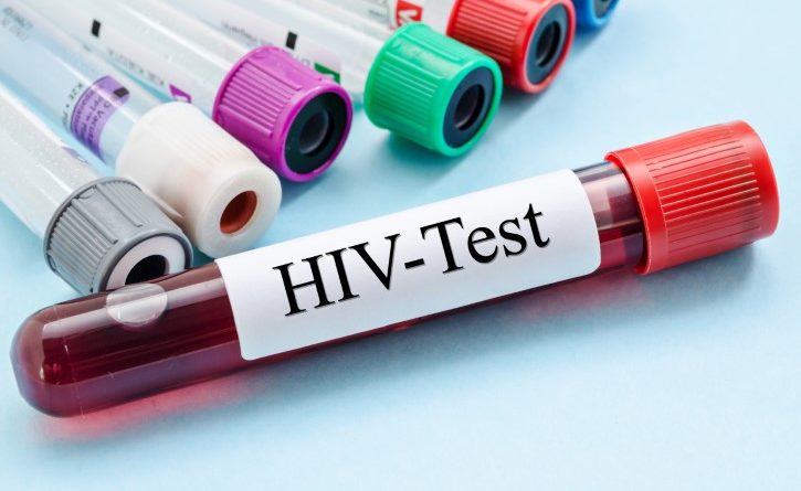 Health Centre Predicts 14,321 Cases Of HIV This Year